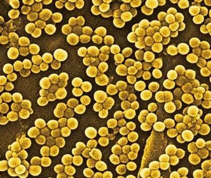 致病菌-金黄色葡萄球菌