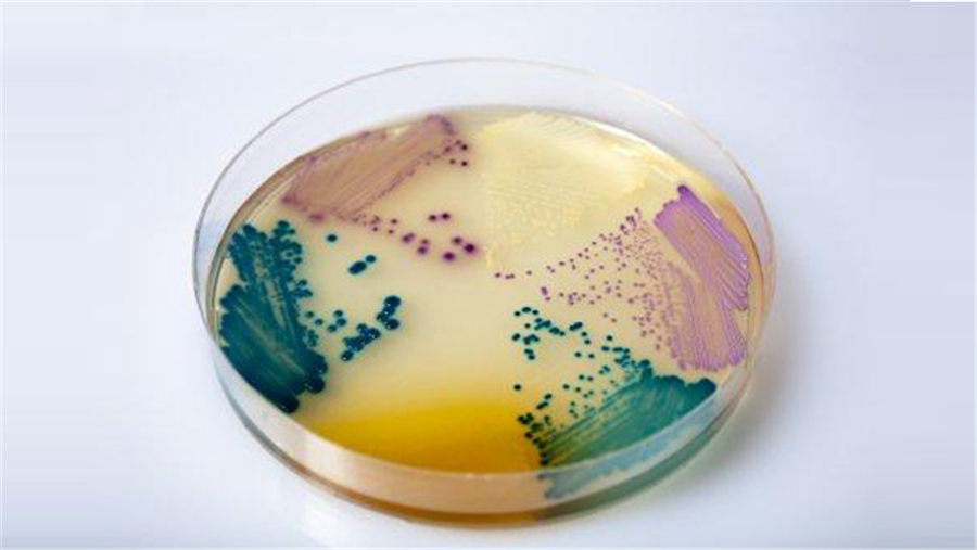 食品检测,微生物实验室培养基质量控制