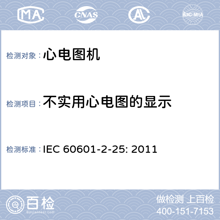 不实用心电图的显示 医用电气设备 第2部分:心电图机安全专用要求 IEC 60601-2-25: 2011 201.12.4.101