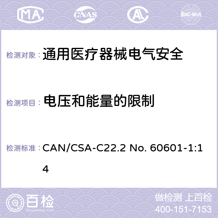 电压和能量的限制 医用电气设备 第1部分安全通用要求 CAN/CSA-C22.2 No. 60601-1:14 8.4