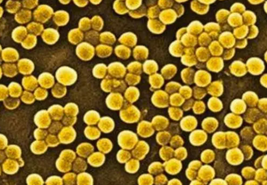 金黄色葡萄球菌检测去哪里做?金黄色葡萄球菌检测标准是什么？